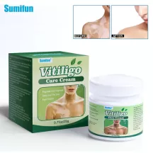 Sumifun Vitiligo Treatment Ointment