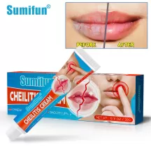 Sumifun Cheilitis Cream